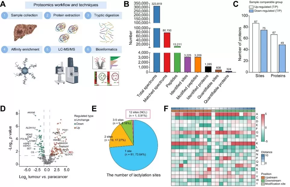 iCCA cells display a widely aberrant landscape of protein lactylation via MS-based lactylation profiling.